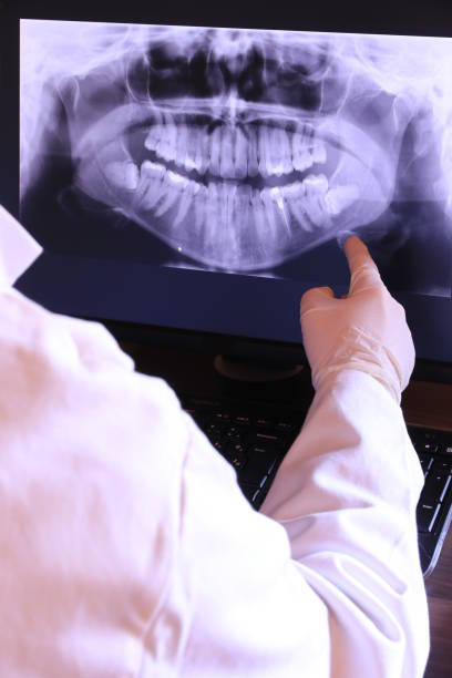 Best Emergency Dentist for Lost Fillings or Crowns in Montpelier, ID