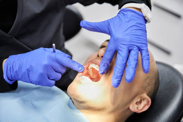 Best Emergency Dentist for Knocked-Out Tooth in Montpelier, ID